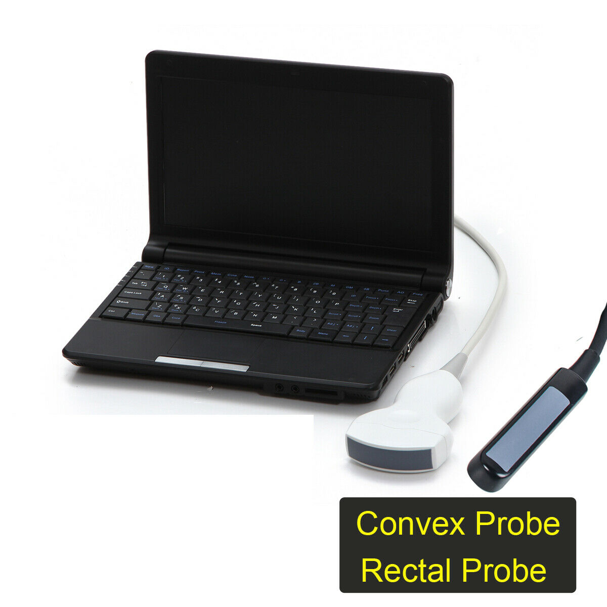 Portable Ultrasonic Ultrasound Scanner Digital Laptop Machine 3.5MHz ConvexProbe DIAGNOSTIC ULTRASOUND MACHINES FOR SALE
