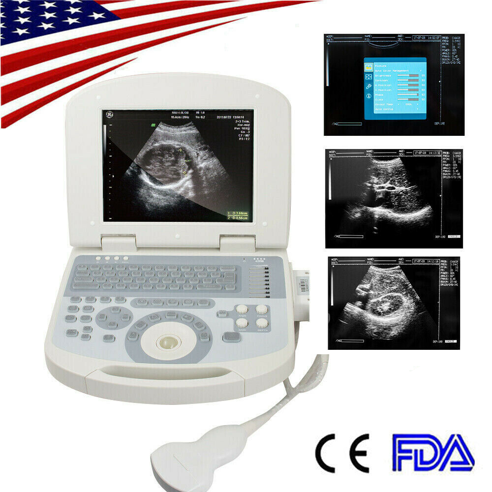 New Portable Notebook Digital Laptop Machine Ultrasound Scanner Convex Probe+3D DIAGNOSTIC ULTRASOUND MACHINES FOR SALE