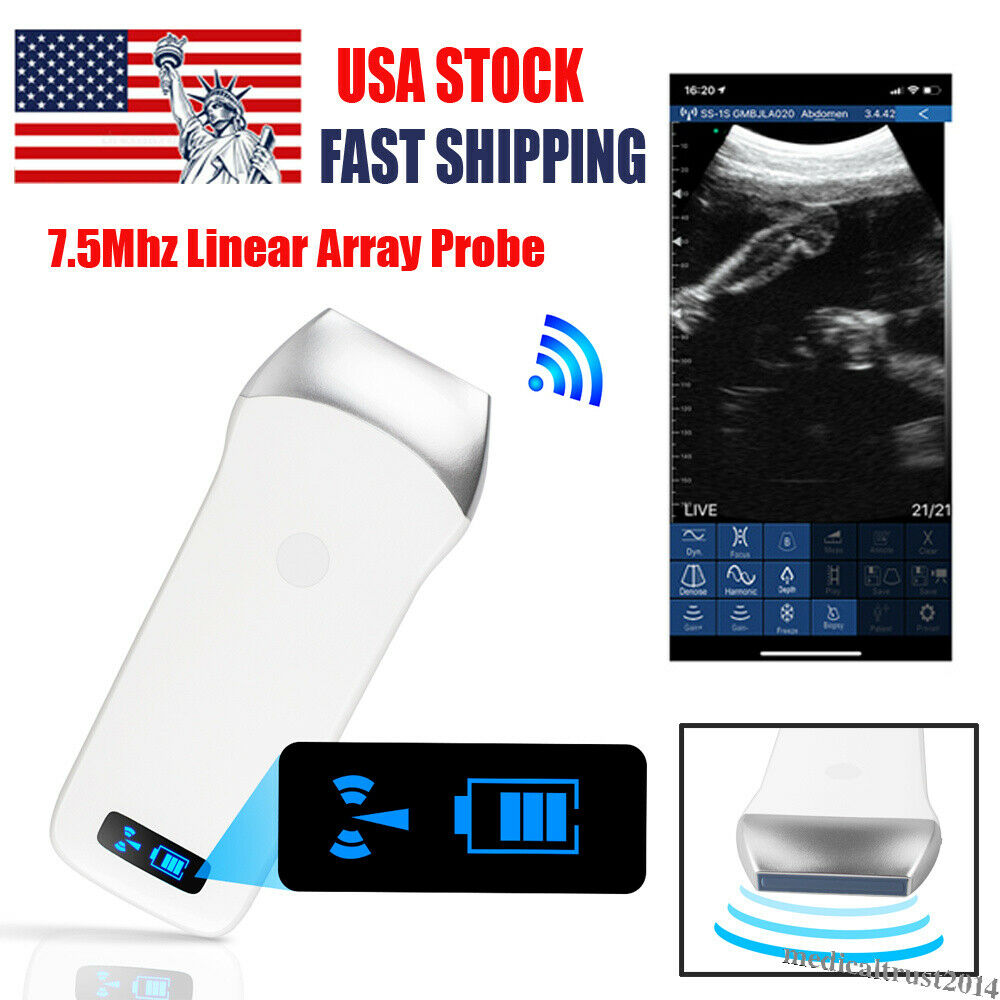 Portable WIFI Wireless Ultrasound Scanner Machine Linear Array Probe 7.5Mhz 80E DIAGNOSTIC ULTRASOUND MACHINES FOR SALE
