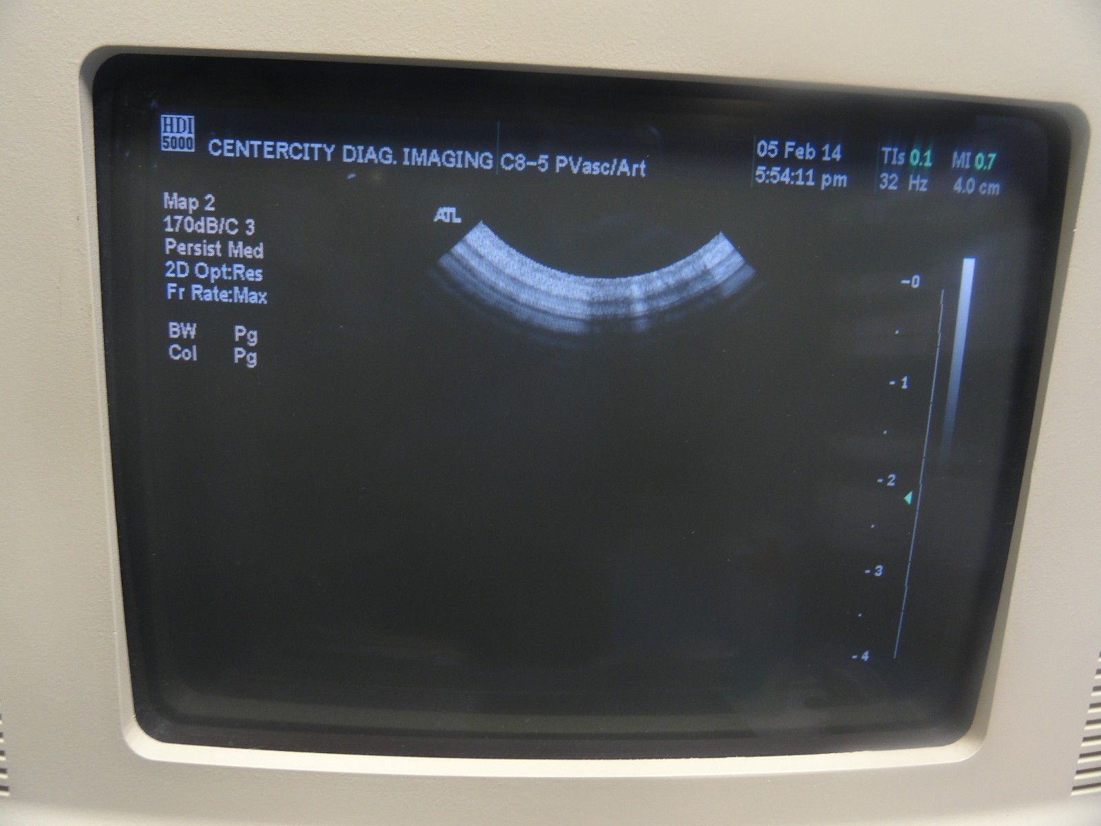 ATL C8-5 14R Micro-Convex 8.0-5.0 MHz Ultrasound Probe (6306) DIAGNOSTIC ULTRASOUND MACHINES FOR SALE