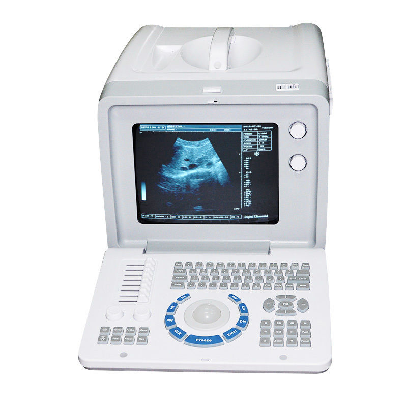 Portable Digital Ultrasound Scanner Machine 3.5MHZ Convex 7.5mhz Linear Probes DIAGNOSTIC ULTRASOUND MACHINES FOR SALE