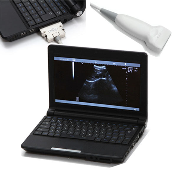 Fast Ship Portable Laptop Ultrasound Scanner+Linear Probe+Free 3D Workstation CE 190891830807 DIAGNOSTIC ULTRASOUND MACHINES FOR SALE