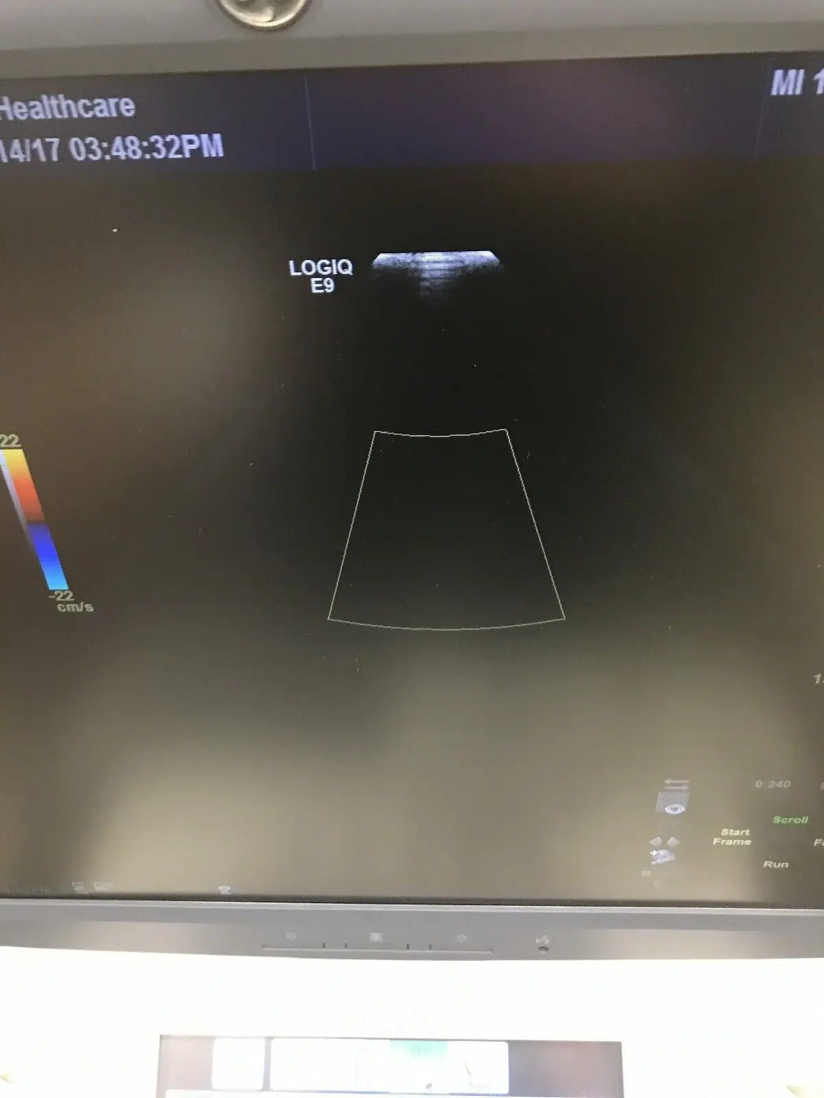 2014 GE S1-5 D probe for GE Ultrasound DIAGNOSTIC ULTRASOUND MACHINES FOR SALE