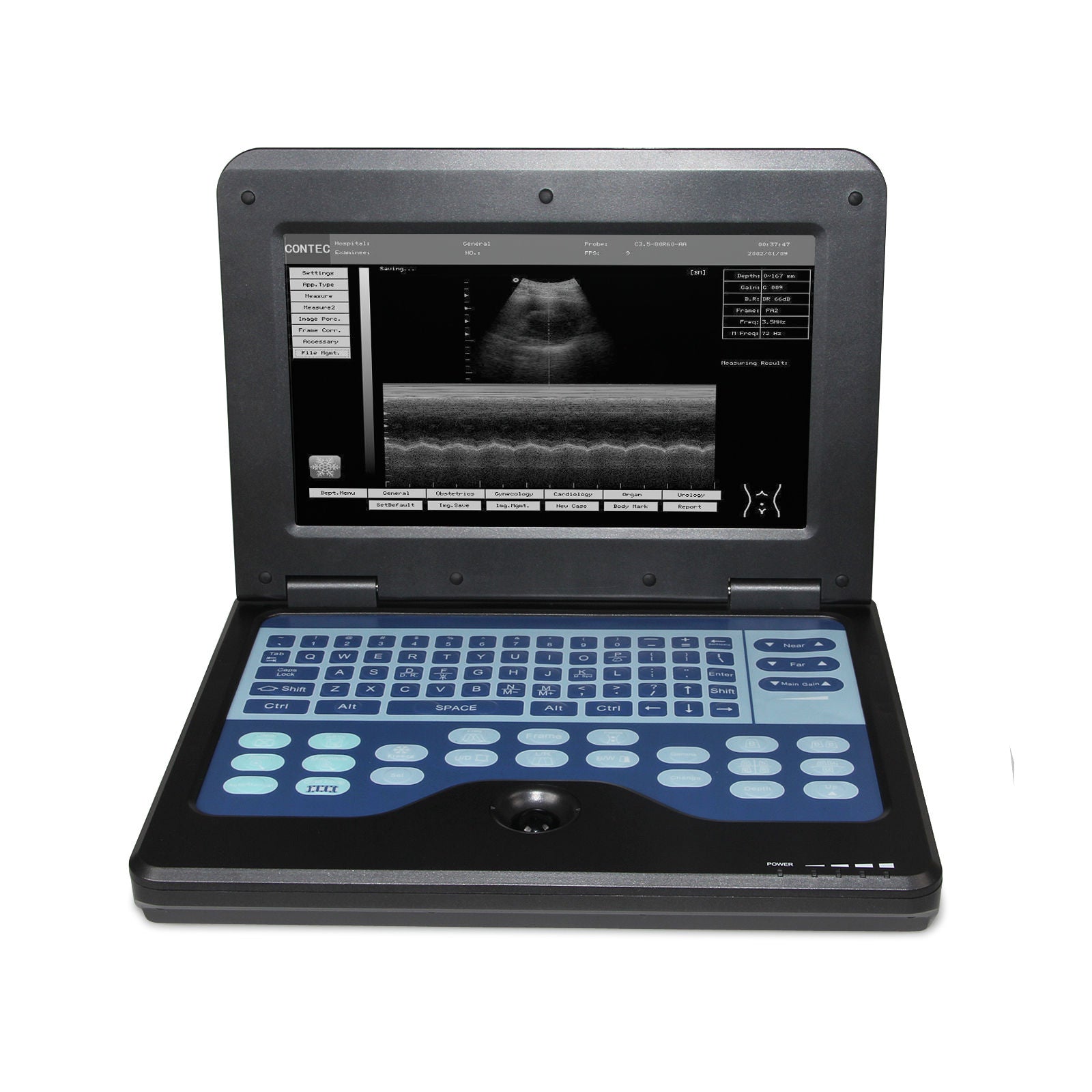 USA Full Digital Portable B-Ultrasoud Scanner 3.5M Convex+7.5M Linear Probe CE 658126923446 DIAGNOSTIC ULTRASOUND MACHINES FOR SALE