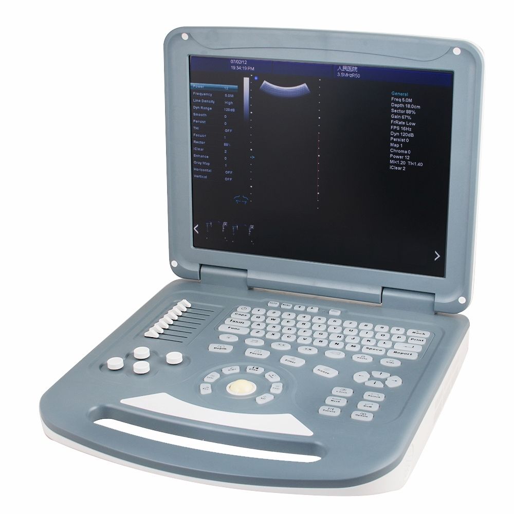 15" Color Ultrasound Scanner Machine Convex Transvaginal 2 Probes Top Quanlity 190891911995 DIAGNOSTIC ULTRASOUND MACHINES FOR SALE