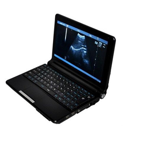 Laptop Ultrasound Scanner/Machine with Convex And Linear and Transvaginal Probe DIAGNOSTIC ULTRASOUND MACHINES FOR SALE