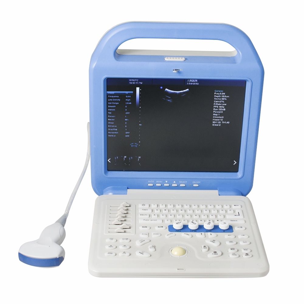 Full Digital Color Doppler Ultrasound Scanner Convex + Linear 2 Sensors/Probe A+ 190891277251 DIAGNOSTIC ULTRASOUND MACHINES FOR SALE