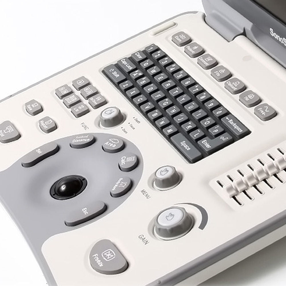 NEW! SonoScape A6 Portable Ultrasound Scanner Machine System + Laptop Style DIAGNOSTIC ULTRASOUND MACHINES FOR SALE