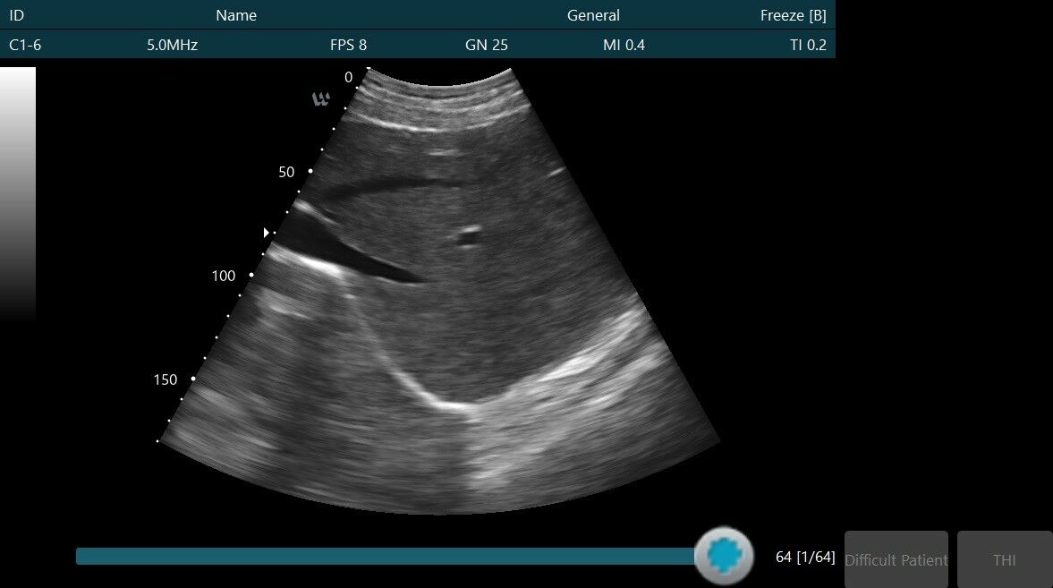 NEW Handheld Veterinary Ultrasound Scanner (probe only) DIAGNOSTIC ULTRASOUND MACHINES FOR SALE