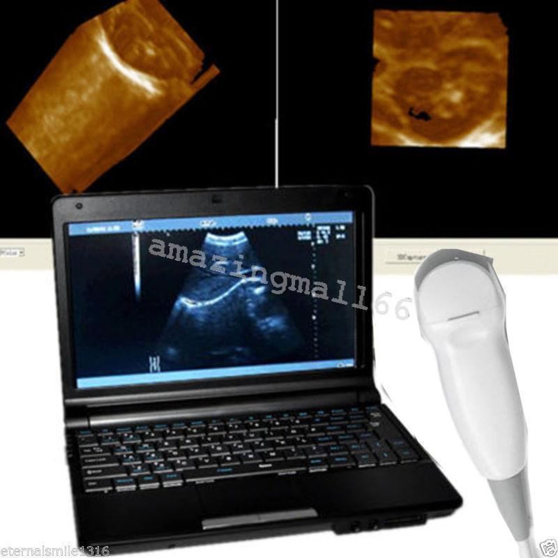 Full Digital Laptop Ultrasound Scanner Probe Micro-Convex Cardiac Probe w 3D Kit 190891462879 DIAGNOSTIC ULTRASOUND MACHINES FOR SALE