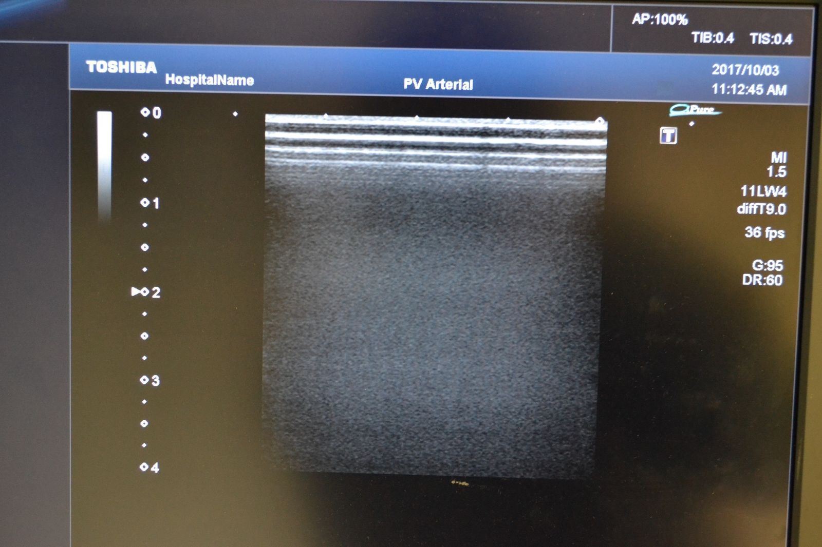 Toshiba Artida PLT-704SBT 11-4.8MHz Linear Ultrasound Transducer Probe J1626 DIAGNOSTIC ULTRASOUND MACHINES FOR SALE