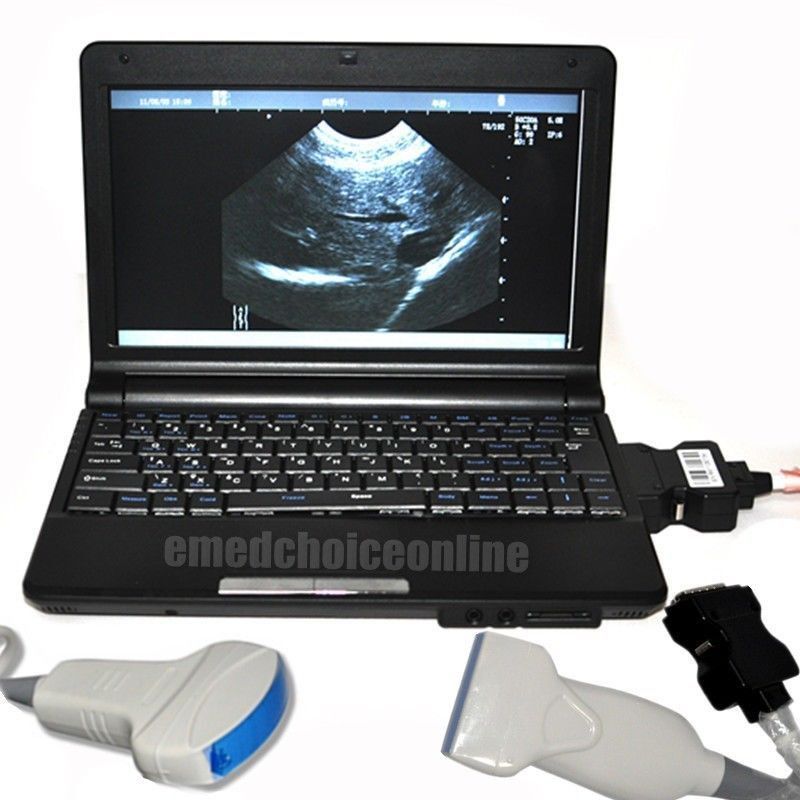 Full Digital Laptop Ultrasound Scanner 2 Probes Covex + Linear Probes 3D Test CE 190891802569 DIAGNOSTIC ULTRASOUND MACHINES FOR SALE