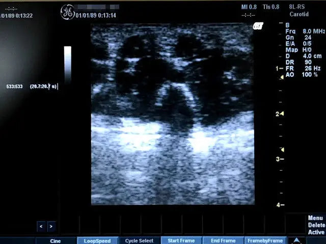 GE LOGIQ BOOK XP ULTRASOUND WITH 3-PROBE DIAGNOSTIC ULTRASOUND MACHINES FOR SALE