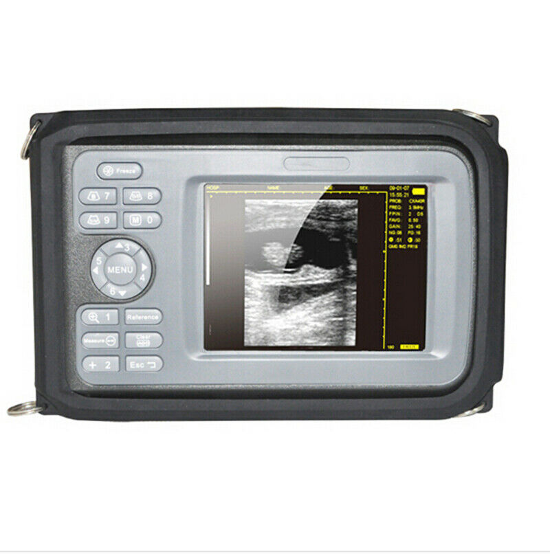 Pro Digital Ultrasound Scanner+Convex Probe Pregnancy Handheld Monitor Machine DIAGNOSTIC ULTRASOUND MACHINES FOR SALE