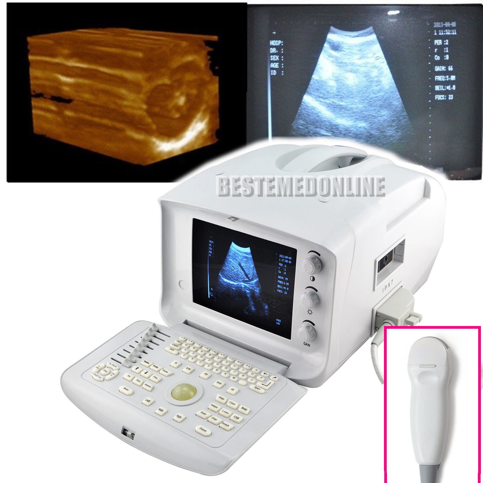 Ultrasound Scanner Micro-Convex Probe Ultrasonic Machine 3D Ultrasound Unit DIAGNOSTIC ULTRASOUND MACHINES FOR SALE