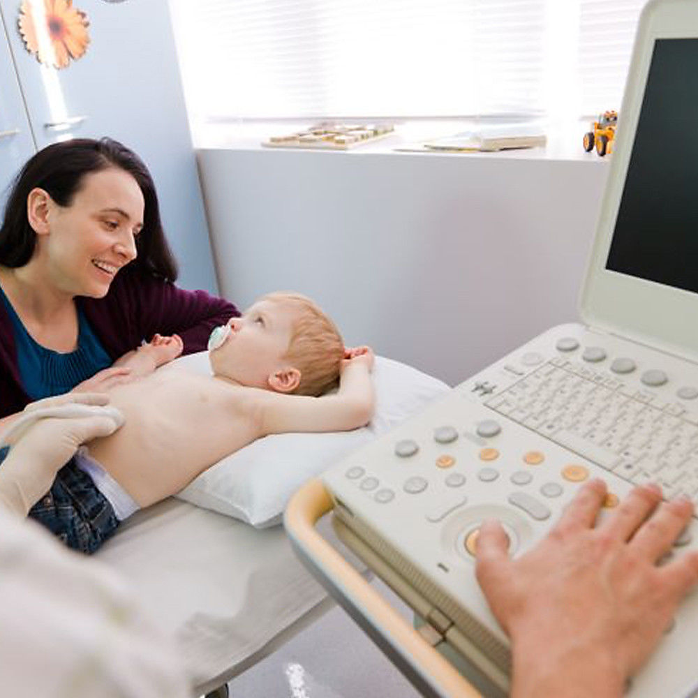 Philips CX50 Portable Ultrasound System with S5-1 Cardiac Sector Transducer DIAGNOSTIC ULTRASOUND MACHINES FOR SALE