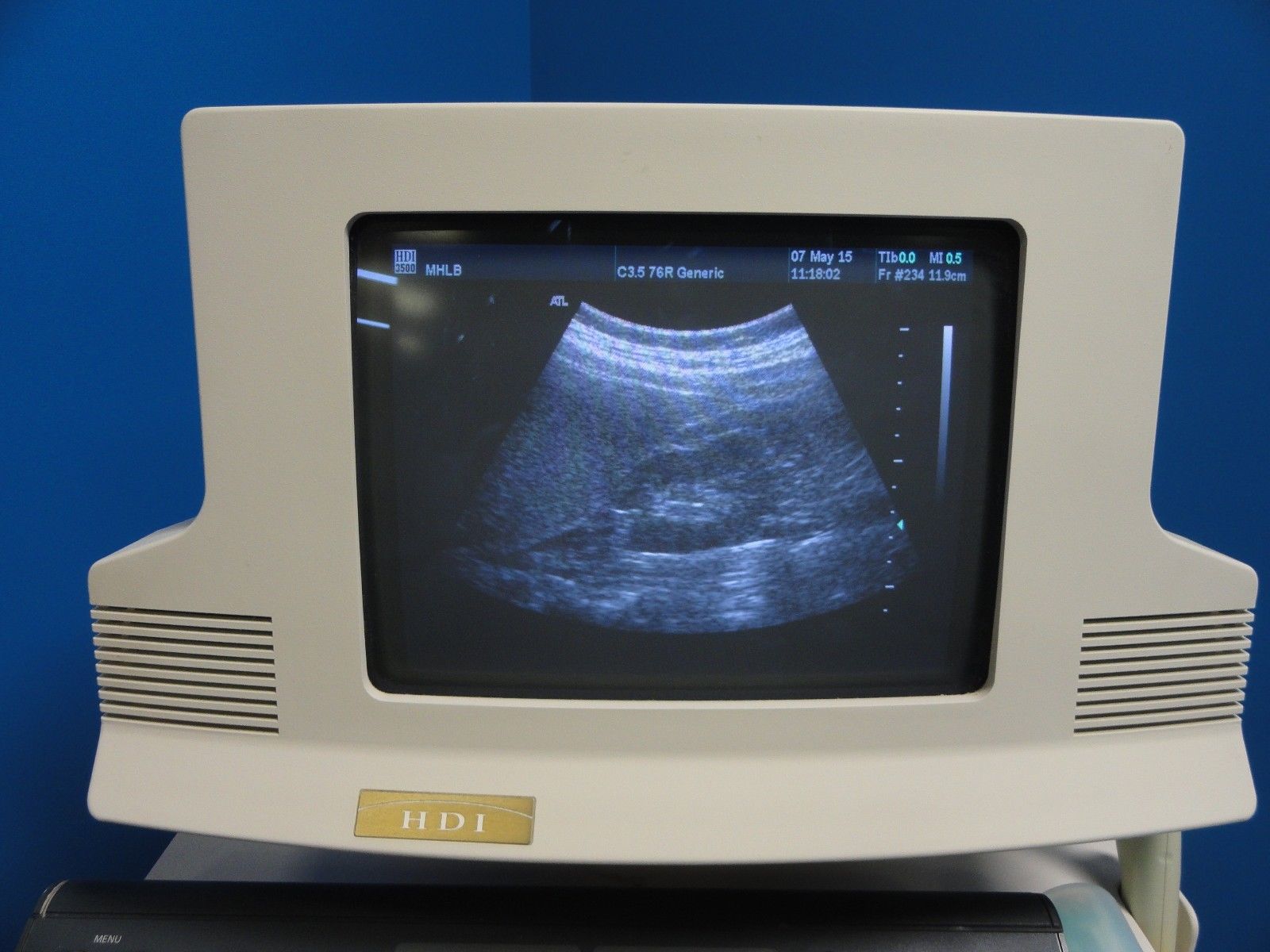 Philips ATL C3.5 76R Convex / Curved Array Ultrasound Transducer Probe (8837) DIAGNOSTIC ULTRASOUND MACHINES FOR SALE