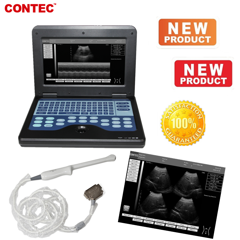 Portable Laptop Ultrasound Scanner Machine Digital Human Tranvaginal Probe DIAGNOSTIC ULTRASOUND MACHINES FOR SALE