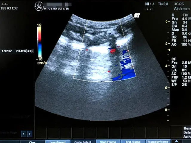 GE LOGIQ BOOK XP ULTRASOUND WITH 3-PROBE DIAGNOSTIC ULTRASOUND MACHINES FOR SALE