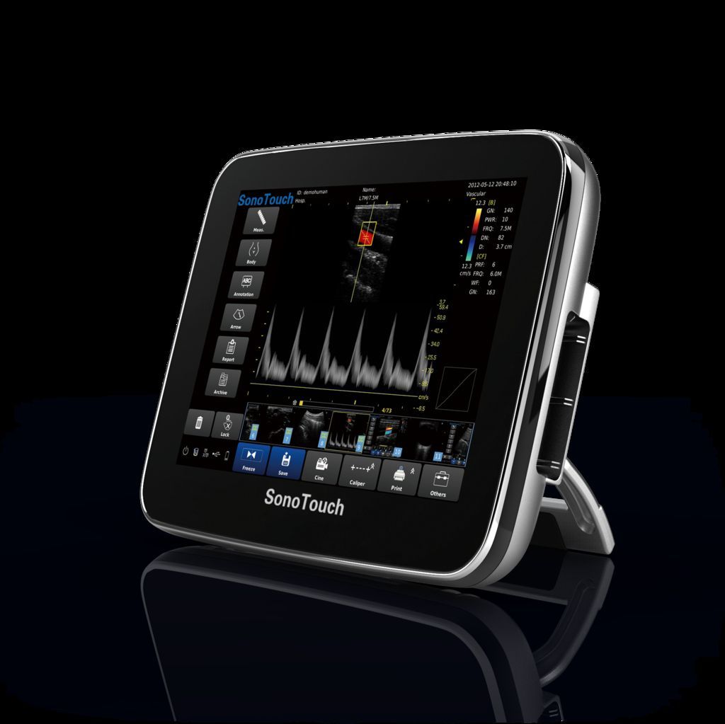 Chison Sonotouch 30 Color Doppler Ultrasound Scanner&two probes-Used DIAGNOSTIC ULTRASOUND MACHINES FOR SALE