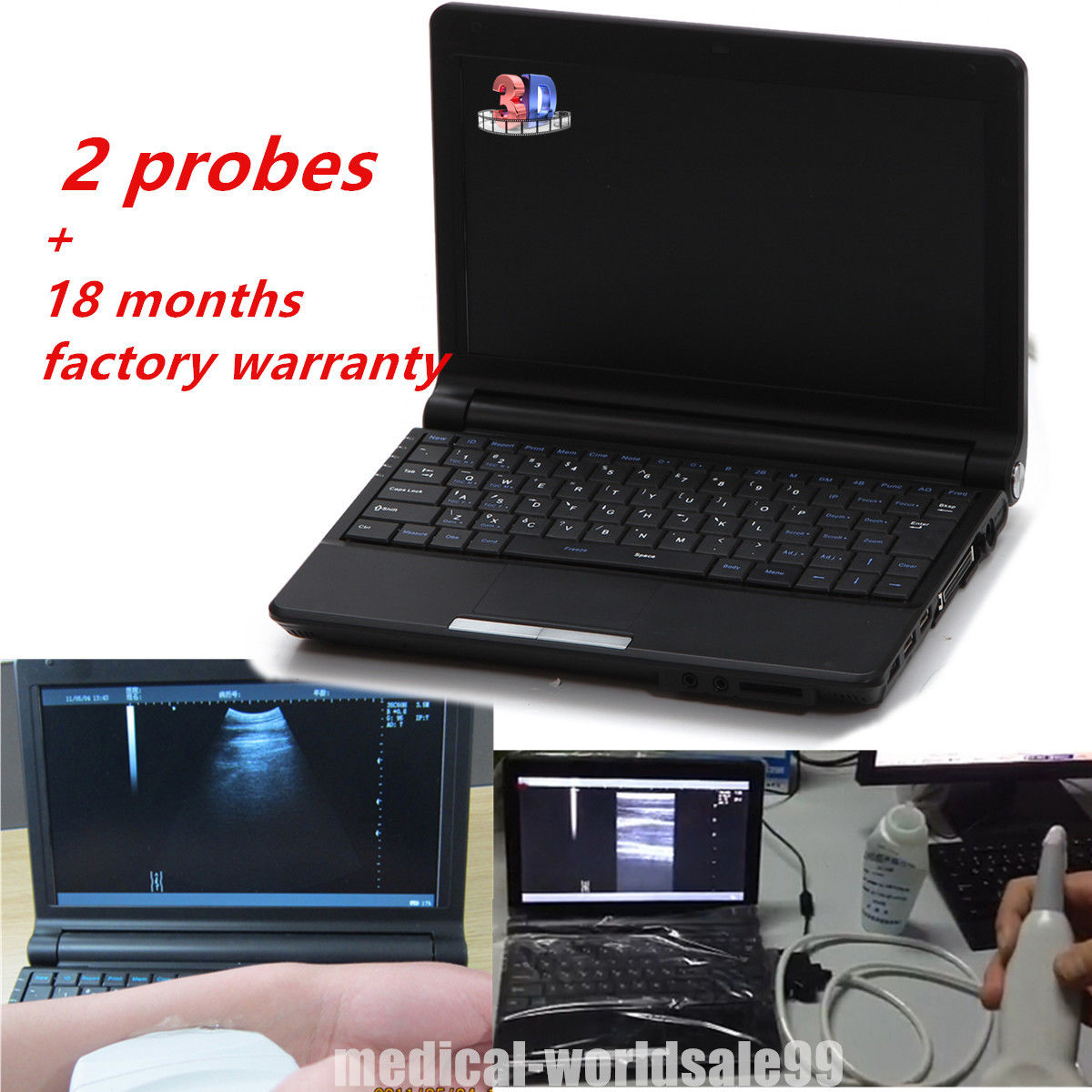 Digital Notebook Laptop Ultrasound Scanner/Machine with Convex + Linear Probe 3D 190891433589 DIAGNOSTIC ULTRASOUND MACHINES FOR SALE
