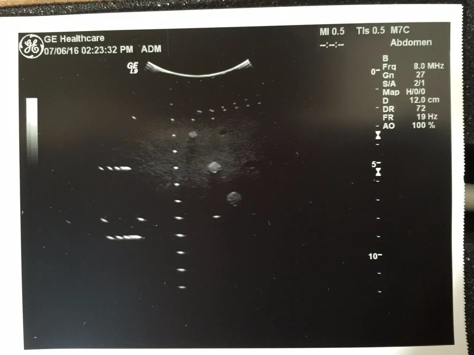 GE M7C Convex Ultrasound Transducer for GE Logiq Systems DIAGNOSTIC ULTRASOUND MACHINES FOR SALE