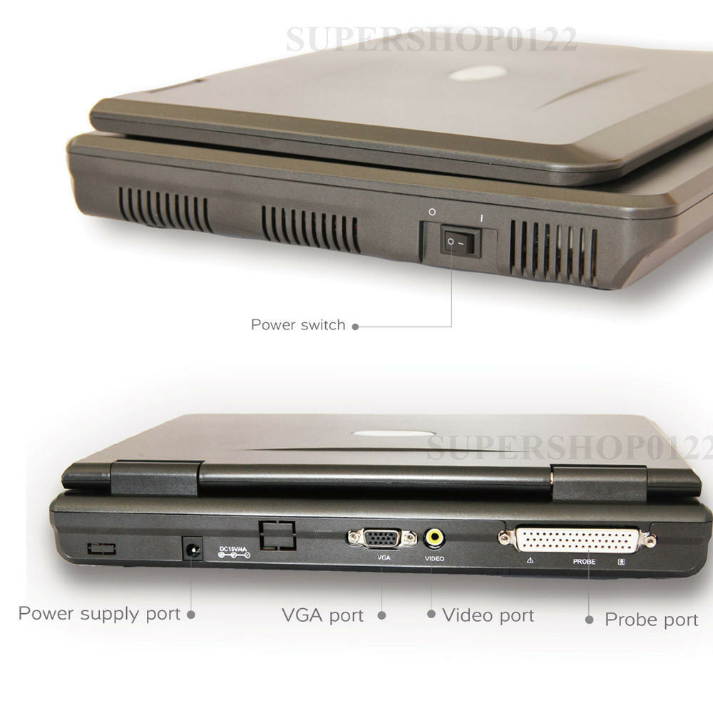 Portable Laptop Ultrasound machine Scanner micro-convex probe CardiacTransducer 658126669122 DIAGNOSTIC ULTRASOUND MACHINES FOR SALE