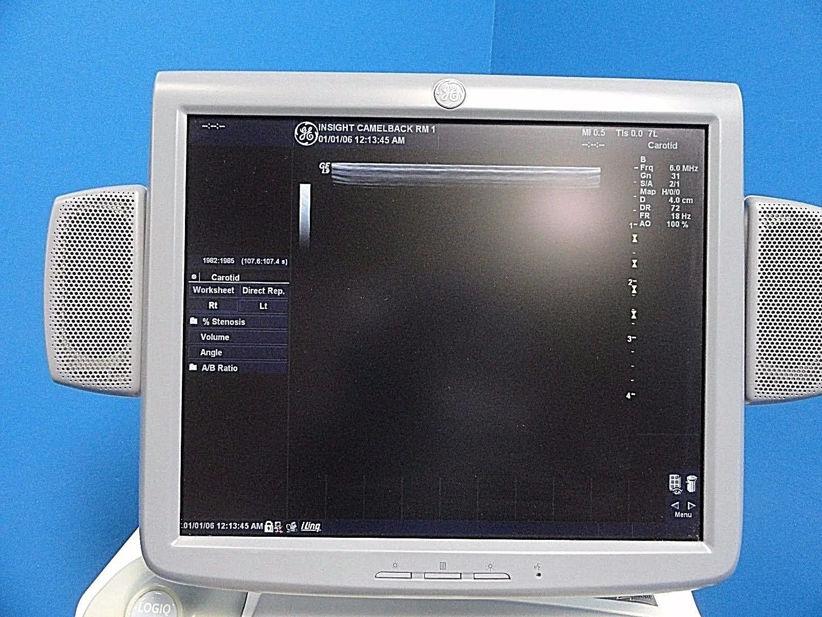 GE 7L Linear Array Ultrasound Probe P/N 2197482 for Logiq & Vivid Series~13729 DIAGNOSTIC ULTRASOUND MACHINES FOR SALE