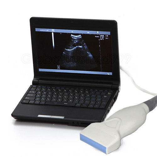 Digital Laptop Ultrasound Scanner machine system 7.5MHZ Linear Sensor/Probe+3D DIAGNOSTIC ULTRASOUND MACHINES FOR SALE