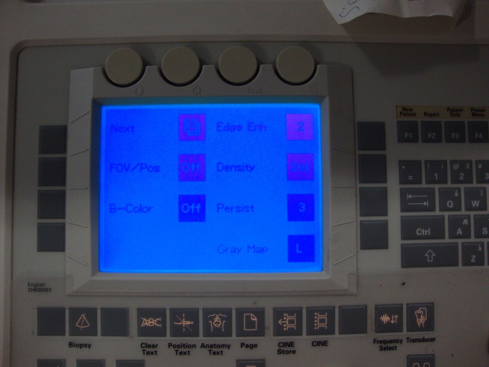 siemens sienna diagnostic ultrasound system GM-6601A2E00 2002 DIAGNOSTIC ULTRASOUND MACHINES FOR SALE