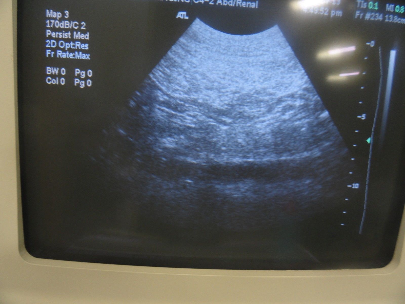 ATL HDI C4-2 40R Curved Array Broadband Probe (Abdominal General Imaging) 5940 DIAGNOSTIC ULTRASOUND MACHINES FOR SALE