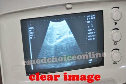 Portable Ultrasound ultrasonic Scanner Machine convex +Transvaginal Probes JXKH! DIAGNOSTIC ULTRASOUND MACHINES FOR SALE