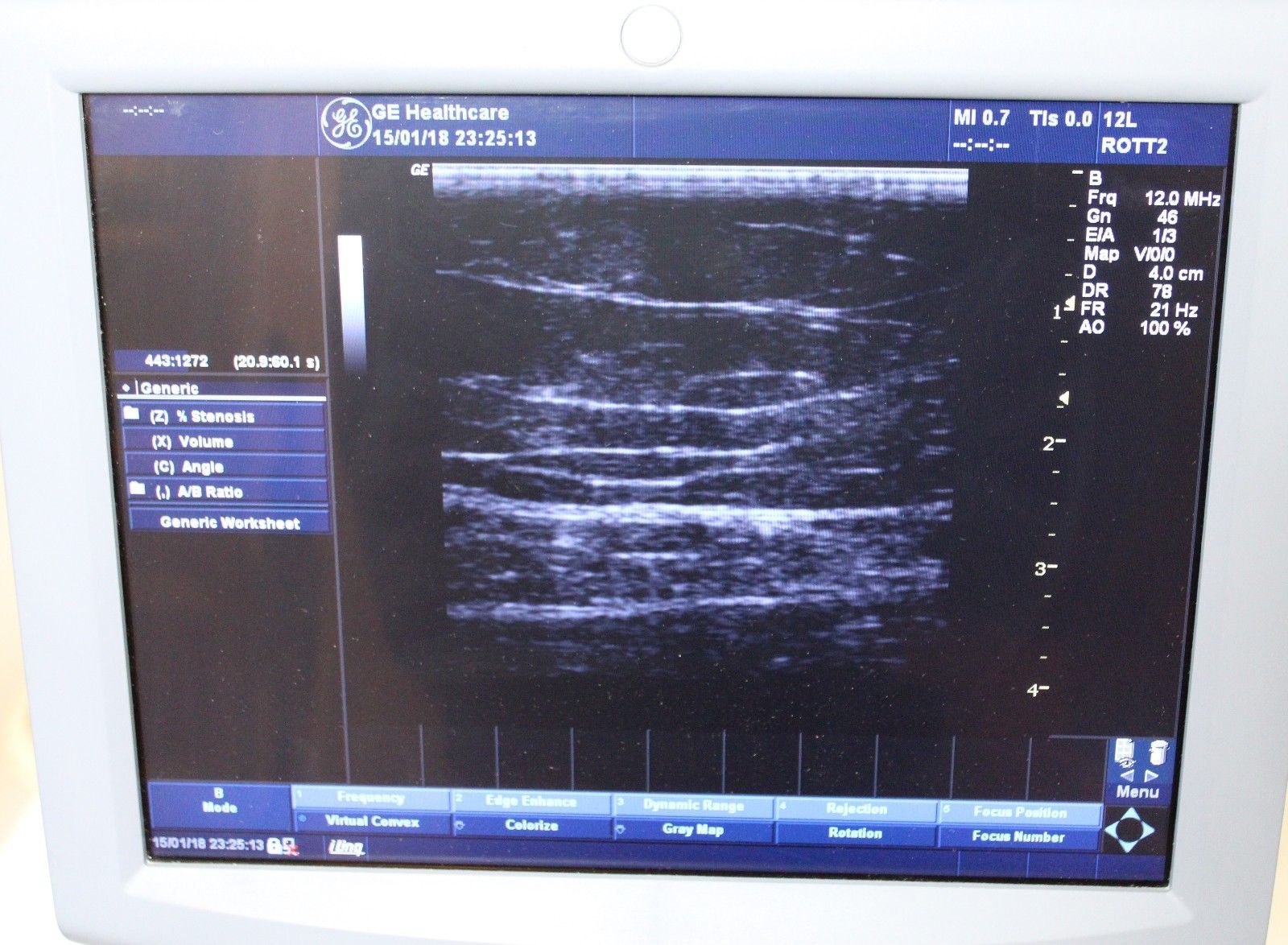 GE Logiq P5 Ultrasound System with 2 Probes DIAGNOSTIC ULTRASOUND MACHINES FOR SALE