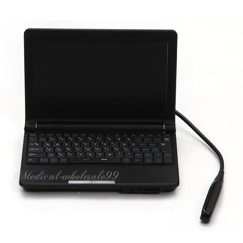 Laptop Machine Veterinary Ultrasound Scanner Covex & Rectal Animal Probe 3D Sale 190891516459 DIAGNOSTIC ULTRASOUND MACHINES FOR SALE