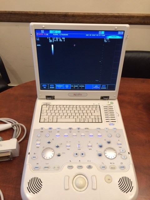 Esaote MyLab Five Portable Ultrasound machine including 2 probes DIAGNOSTIC ULTRASOUND MACHINES FOR SALE