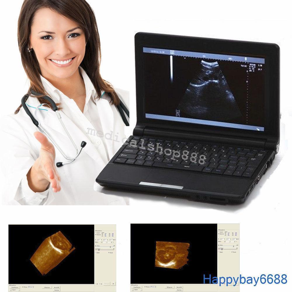 Sale! 10Inch Laptop Ultrasound Scanner with linear probe 3D Ultrasound Device 190891478627 DIAGNOSTIC ULTRASOUND MACHINES FOR SALE