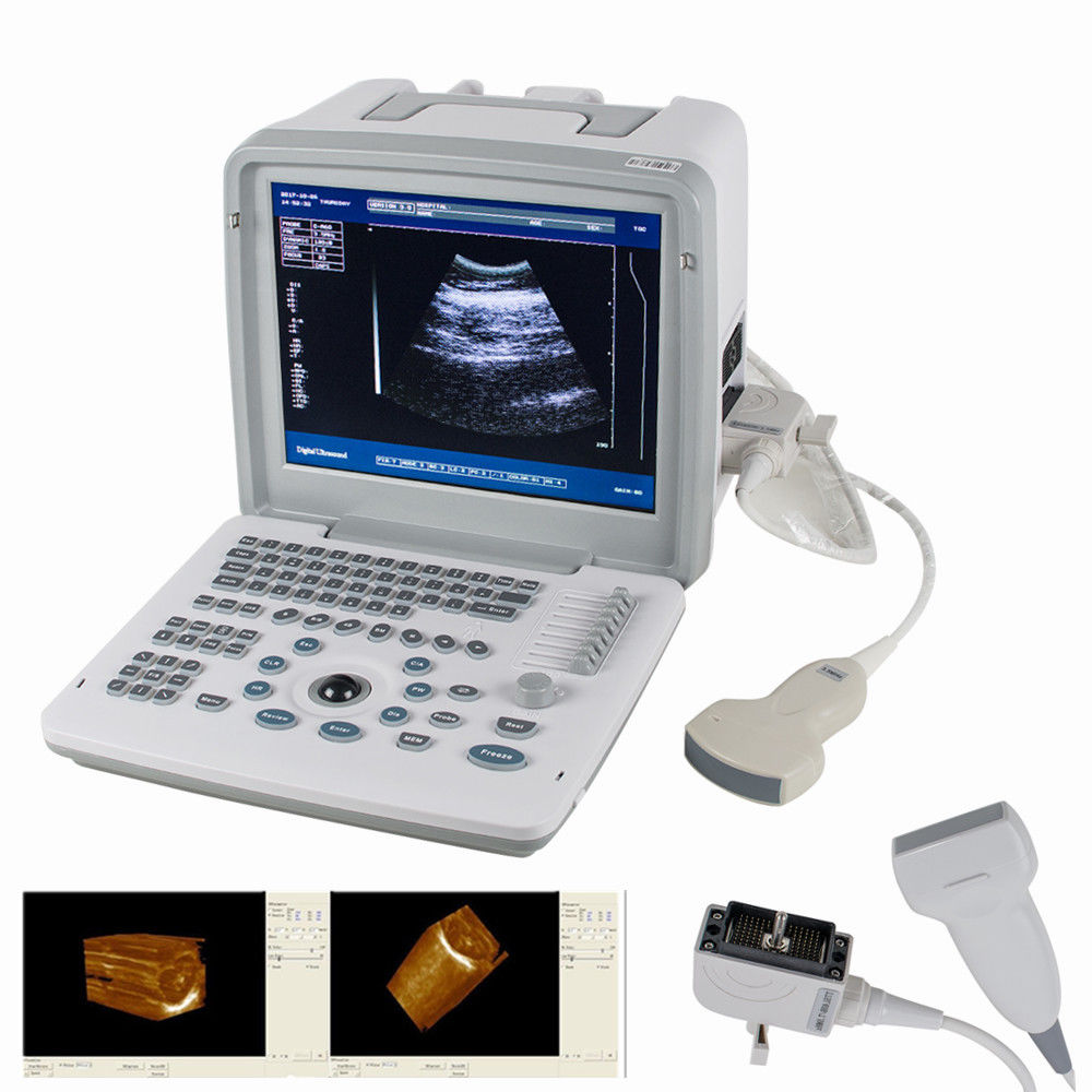 Hot S+Digital SVGA 3D Portable Ultrasound Scanner Machine Convex Linear 2 Probe 190891580481 DIAGNOSTIC ULTRASOUND MACHINES FOR SALE