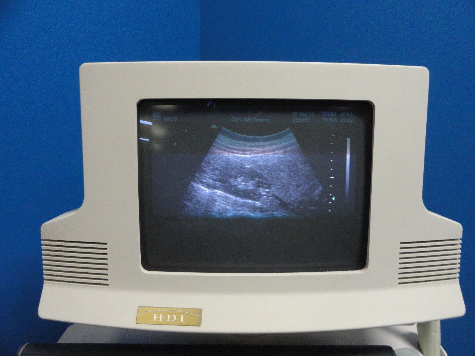 ATL C3.5 76R Convex / Curved Array Ultrasound Transducer Probe (8841) DIAGNOSTIC ULTRASOUND MACHINES FOR SALE