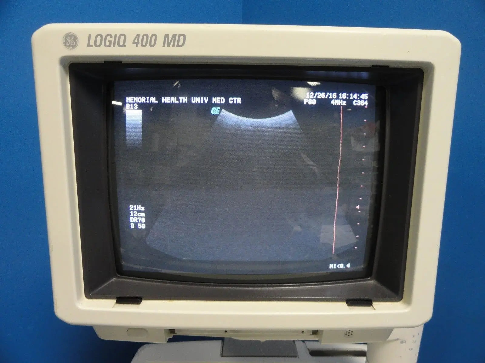 GE Logiq 400 MD Soft Pack Ultrasound W/ C364, C551, 739L Probes & Printer~12413 DIAGNOSTIC ULTRASOUND MACHINES FOR SALE