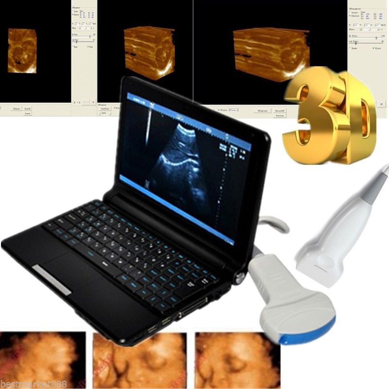Digital Laptop Ultrasound Scanner with Convex Probe+Linear probe +3D software DIAGNOSTIC ULTRASOUND MACHINES FOR SALE