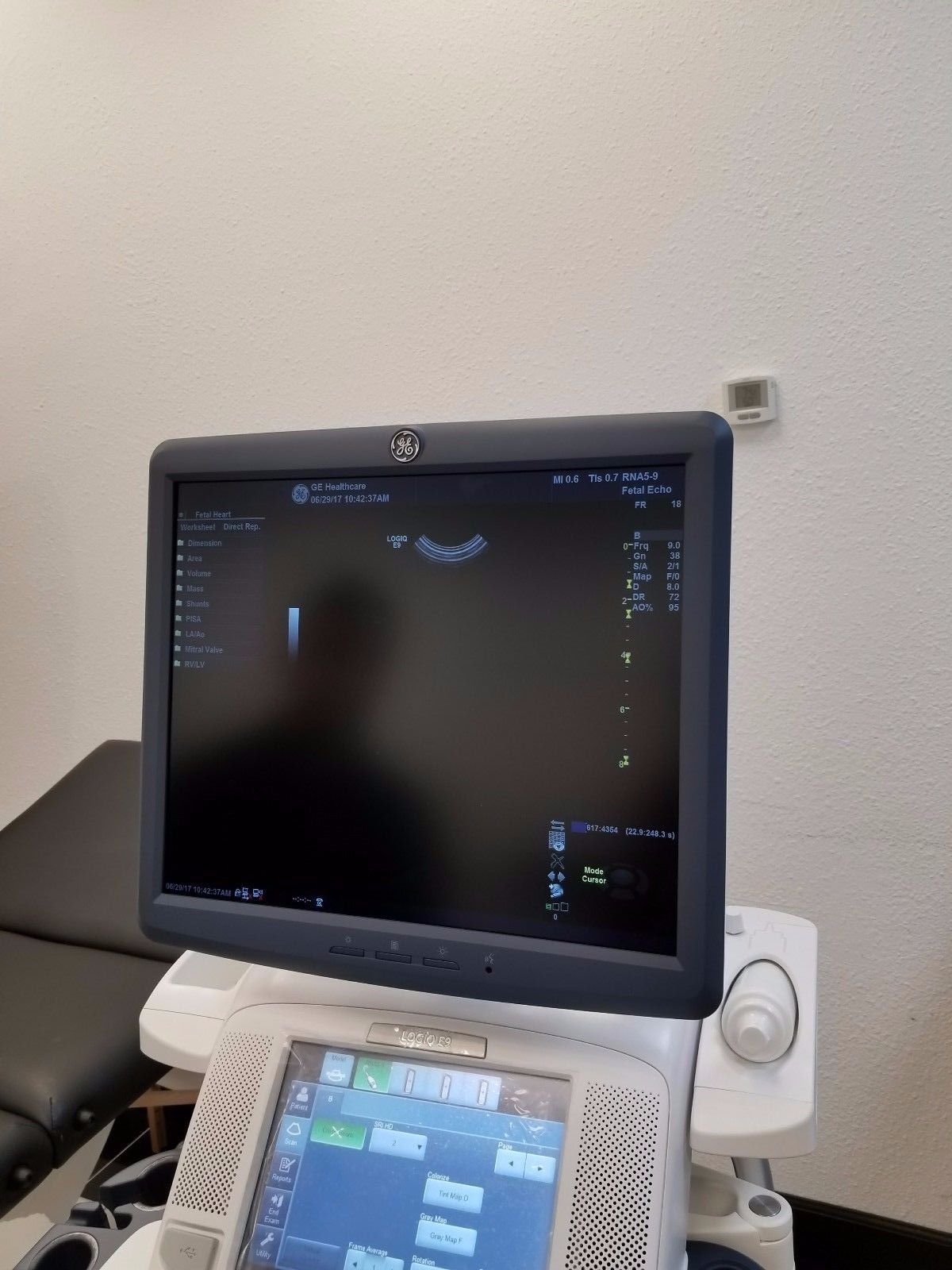 GE RNA5-9-D Ultrasound Probe / Transducer DIAGNOSTIC ULTRASOUND MACHINES FOR SALE