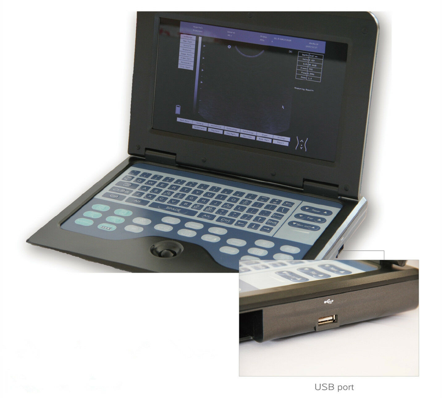 Portable Laptop Ultrasound Scanner + Convex/Linear/Cardiac/Transvaginal 4 probes DIAGNOSTIC ULTRASOUND MACHINES FOR SALE