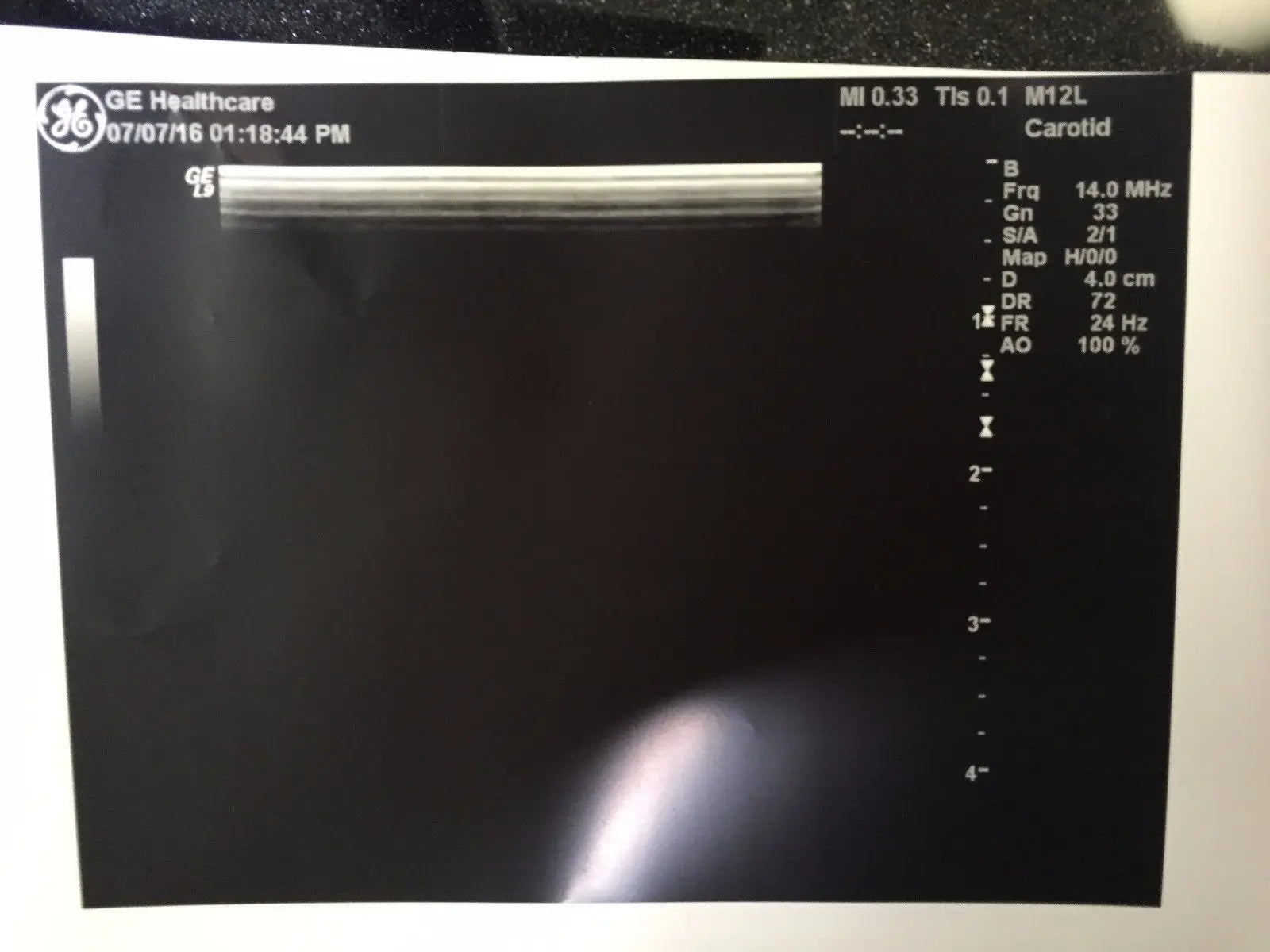 GE M12L Ultrasound Transducer for GE Logiq Systems DIAGNOSTIC ULTRASOUND MACHINES FOR SALE