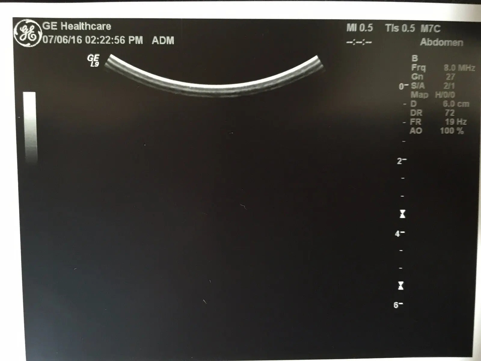 GE M7C Convex Ultrasound Transducer for GE Logiq Systems DIAGNOSTIC ULTRASOUND MACHINES FOR SALE