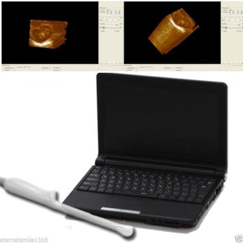 Full Digital Laptop Ultrasound Scanner Probe 6.0mhz Transvaginal Probe 3D Kit 190891462466 DIAGNOSTIC ULTRASOUND MACHINES FOR SALE