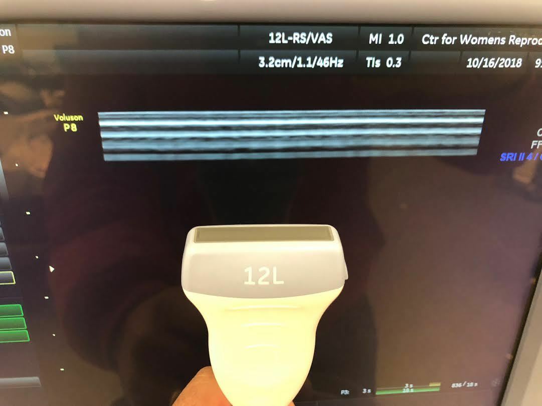 GE Voluson P8 Ultrasound Machine with E8C-RS, 12-RS, 4C-RS Probes DIAGNOSTIC ULTRASOUND MACHINES FOR SALE
