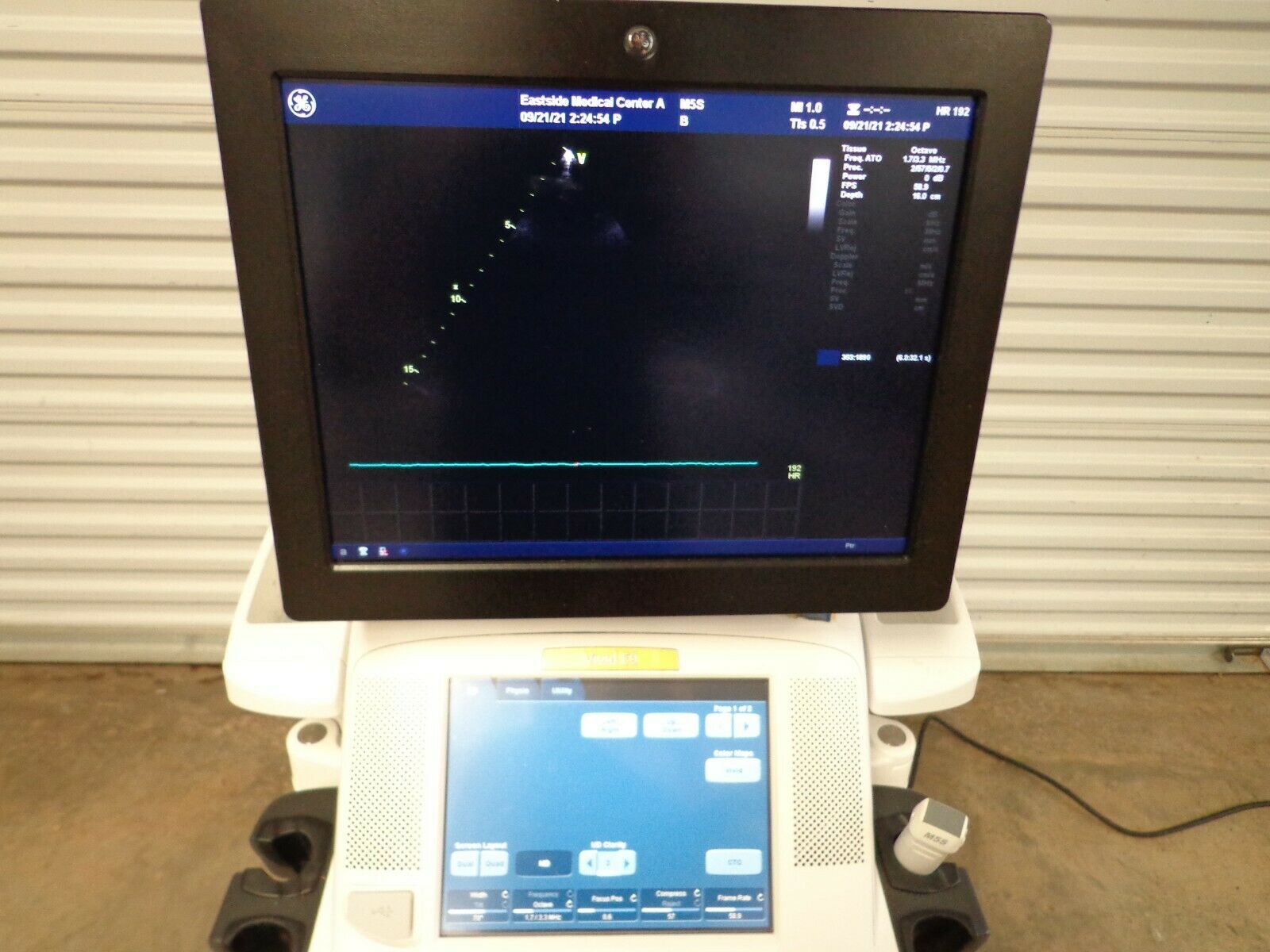 GE VIVID E9 Ultrasound System M5S Probe Color Roll DIAGNOSTIC ULTRASOUND MACHINES FOR SALE