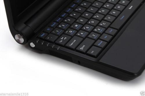 Laptop Ultrasound machine Scanner system 7.5Mhz High Frequecy Linear Probe+3D A+ DIAGNOSTIC ULTRASOUND MACHINES FOR SALE