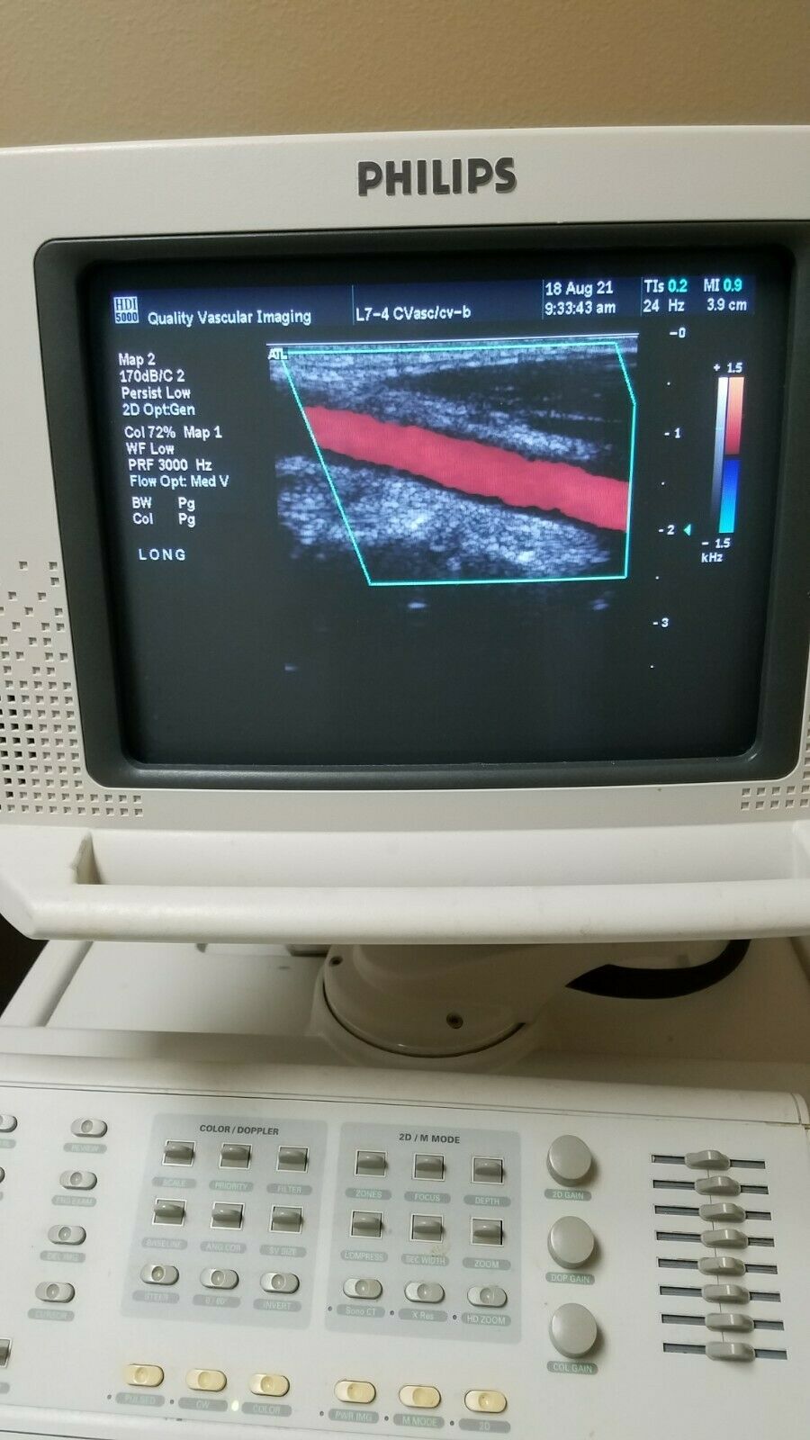 Phillips HDI 5000 Ultrasound Instrument DIAGNOSTIC ULTRASOUND MACHINES FOR SALE