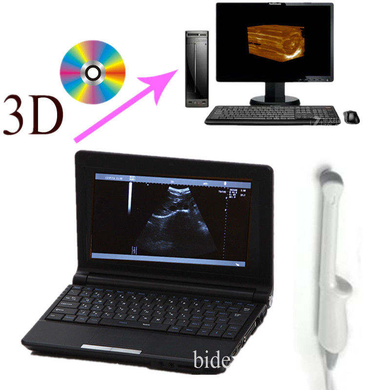 Full Digital Laptop 3D Ultrasound Scanner 6.5 MHZ transvaginal Probe Pregnancy DIAGNOSTIC ULTRASOUND MACHINES FOR SALE